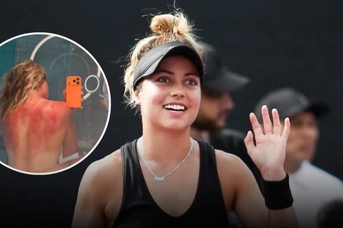 Así quedó la espalda de Renata Zarazúa por el sol de Australia durante partido de tenis (FOTO)