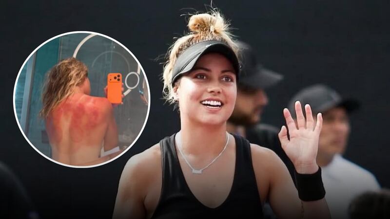 Así quedó la espalda de Renata Zarazúa por el sol de Australia durante partido de tenis (FOTO)
