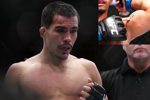 Despedido y bajo amenazas, el futuro incierto de Igor Severino, quien mordió a Andre Lima en UFC